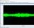 icSpeech - This is a multi-parameter speech biofeedback and recording tool that lets you view and analyse acoustic and video information on your PC