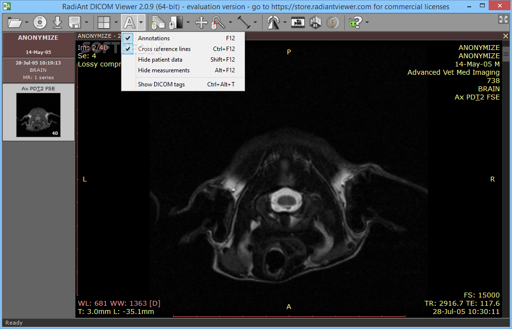 radiant dicom viewer for mac free download