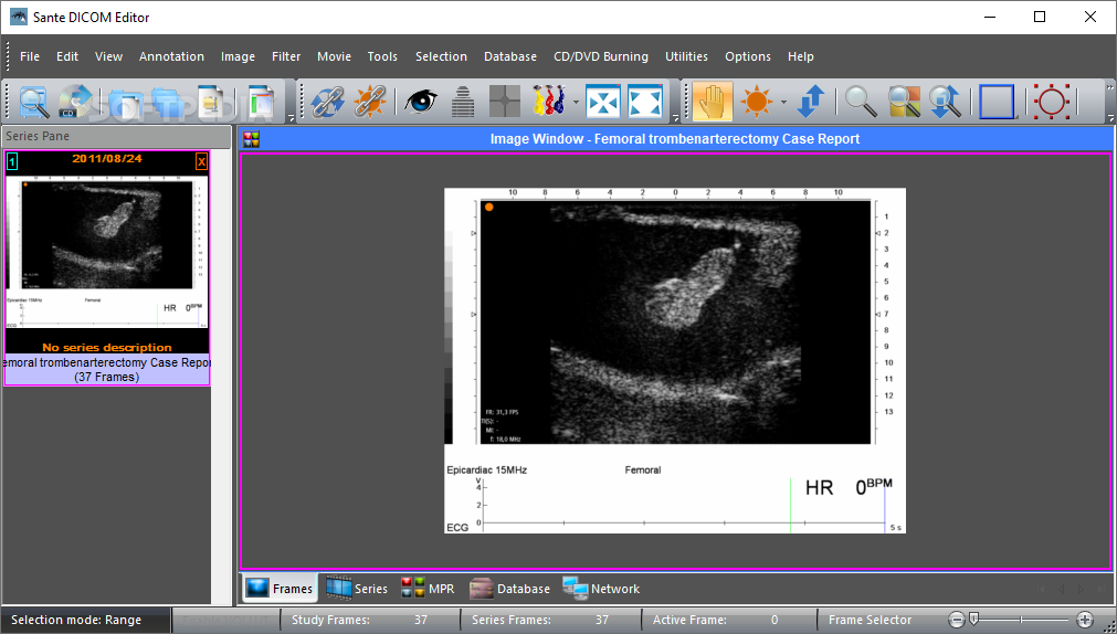 Sante DICOM Editor 8.2.5 instal the new version for android