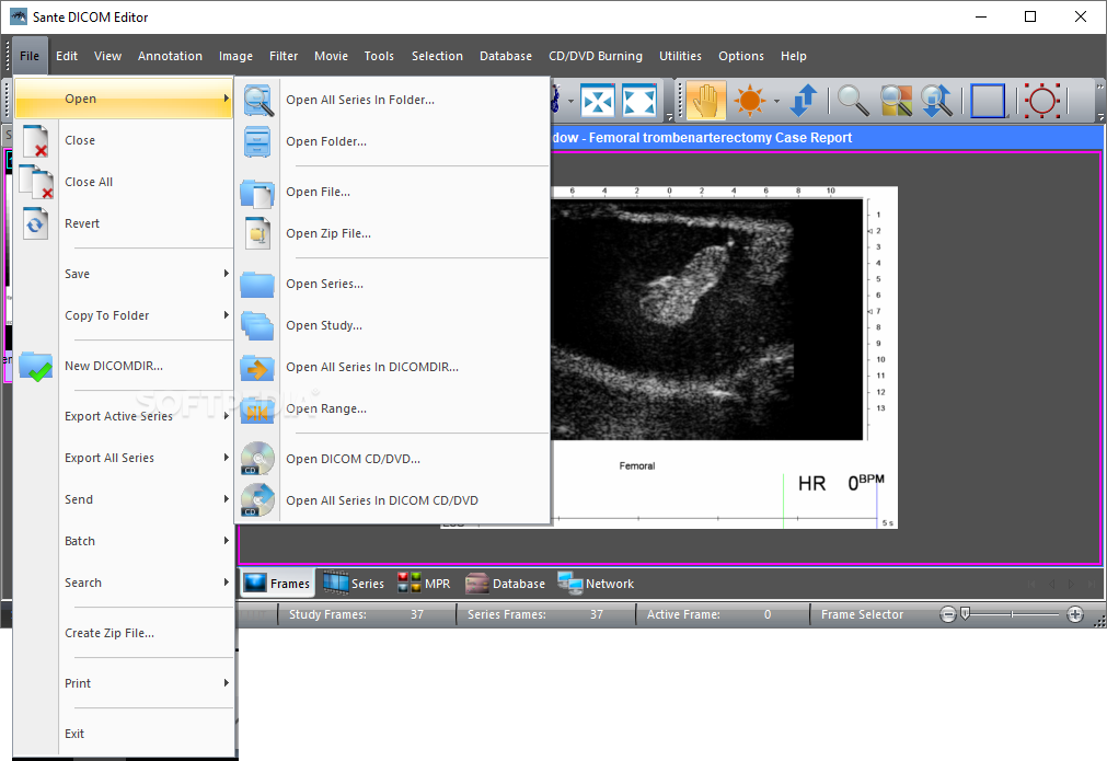 free for mac instal Sante DICOM Editor 8.2.5