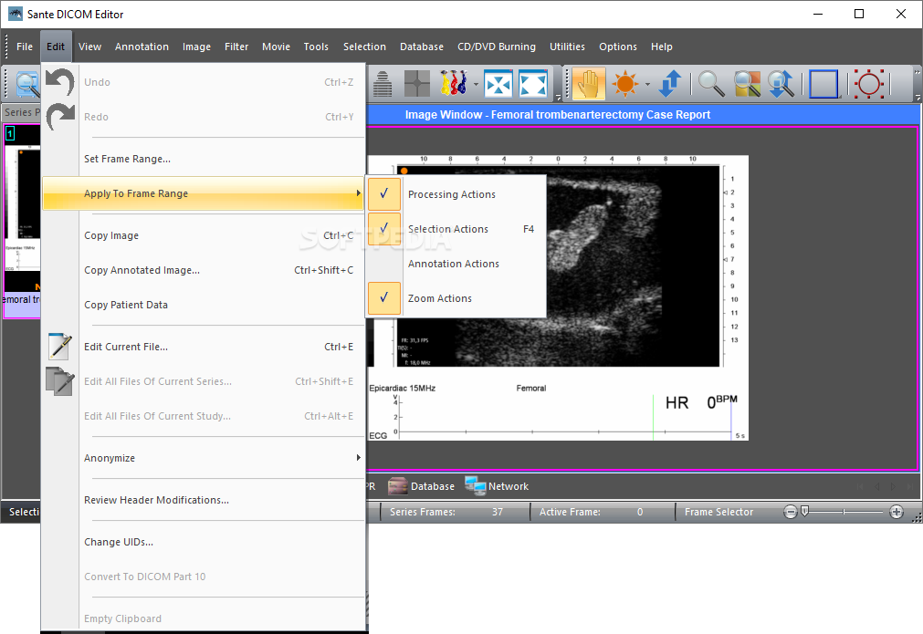 for windows download Sante DICOM Editor 10.0.1