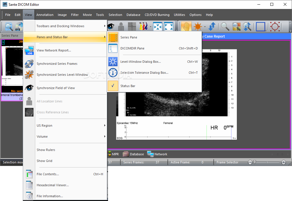 Sante DICOM Editor 8.2.5 instal the new