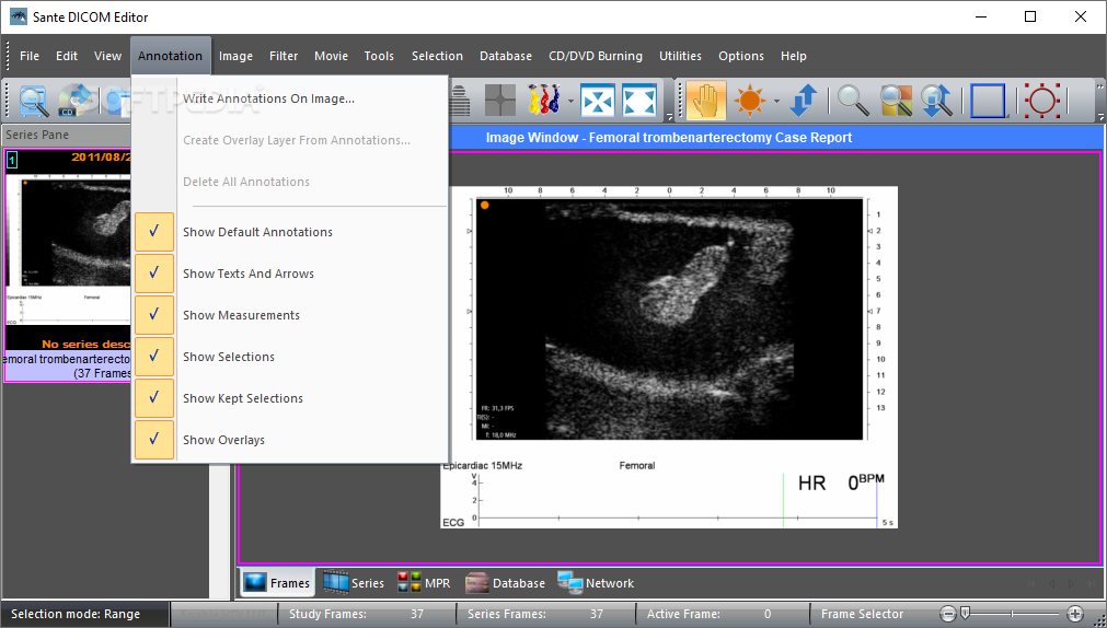 download the new version for apple Sante DICOM Viewer Pro 12.2.5