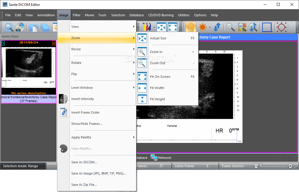 download the new version for ipod Sante DICOM Editor 8.2.5