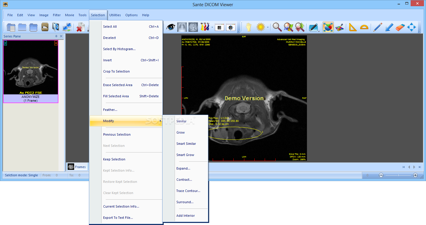 free Sante DICOM Viewer Pro 12.2.5 for iphone download