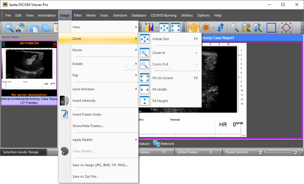 Sante DICOM Viewer Pro 12.2.5 for ios instal