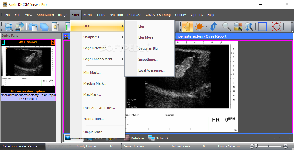 Sante DICOM Viewer Pro 12.2.8 download the new version for windows