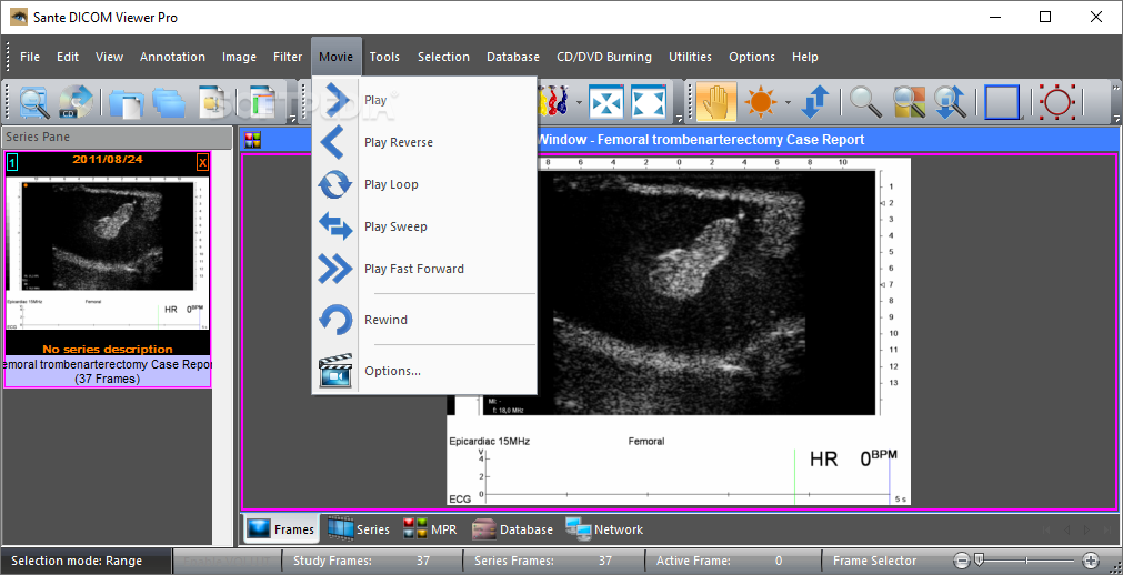 download the new for android Sante DICOM Editor 8.2.5