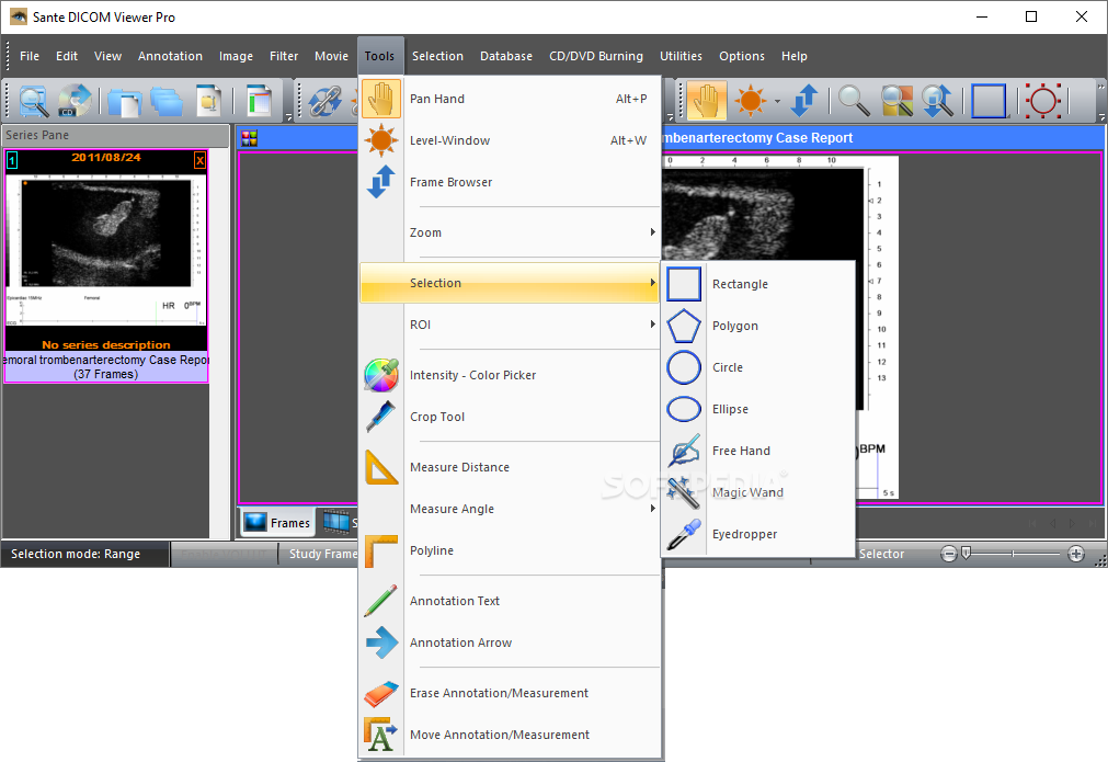 instal the last version for ipod Sante DICOM Viewer Pro 14.0.1