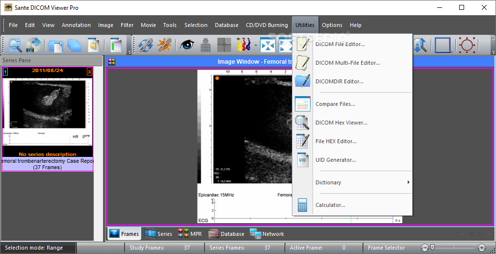 download the last version for iphoneSante DICOM Viewer Pro 12.2.8
