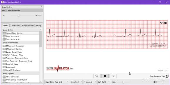 ECG Simulator screenshot
