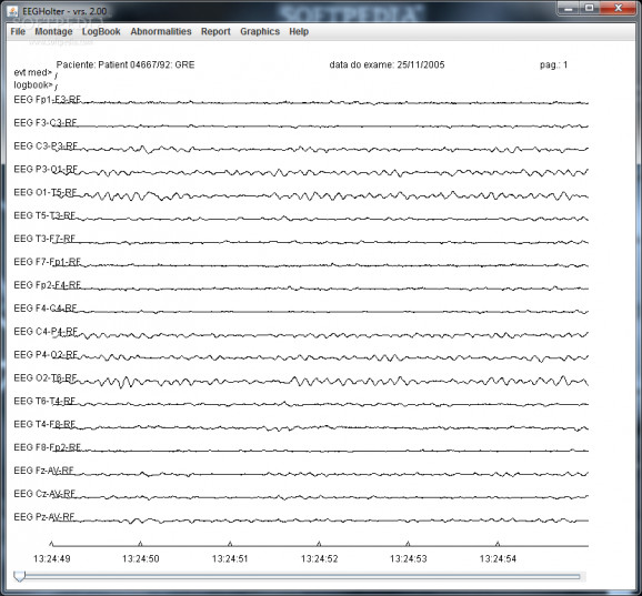 EEG-Holter screenshot