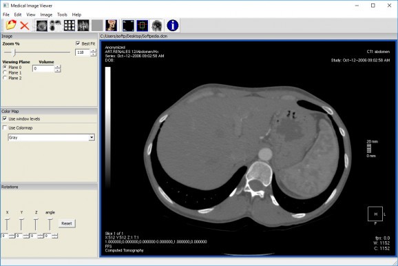 Medical Image Viewer (MIView) screenshot