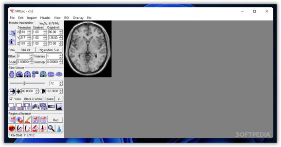 MRIcro screenshot